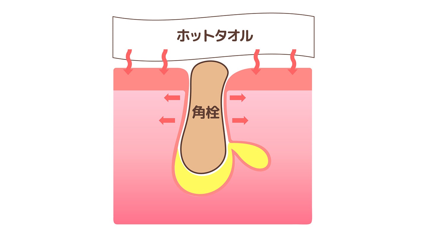 洗顔前に蒸しタオルで毛穴を開く