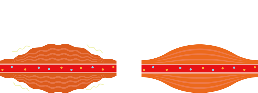 疲労時の筋肉と通常時の筋肉